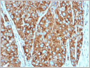 product-image-AAA23908_IHC2.jpg