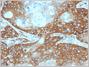 product-image-AAA23908_IHC3.jpg