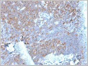 product-image-AAA23908_IHC4.jpg
