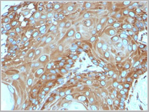 product-image-AAA23908_IHC5.jpg