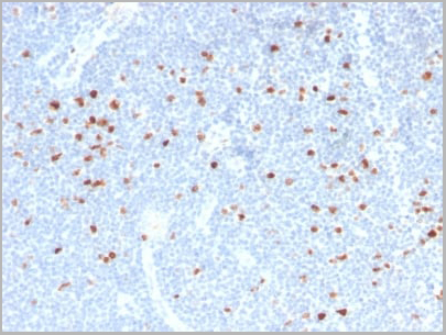 product-image-AAA23909_IHC4.jpg