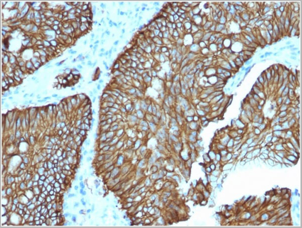 product-image-AAA23911_IHC.jpg