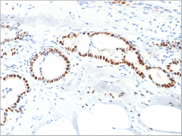 product-image-AAA23914_IHC2.jpg