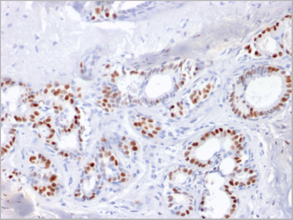 product-image-AAA23914_IHC3.jpg