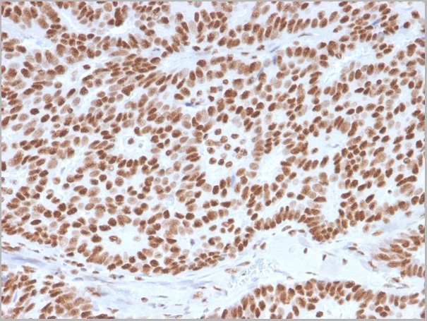 product-image-AAA23915_IHC.jpg