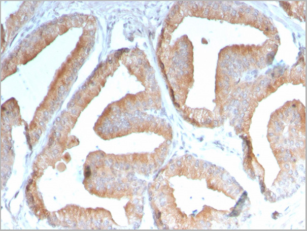 product-image-AAA23916_IHC.jpg