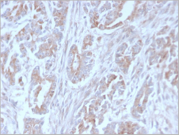 product-image-AAA23916_IHC2.jpg