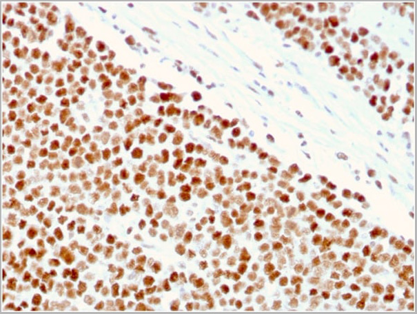 product-image-AAA23917_IHC.jpg