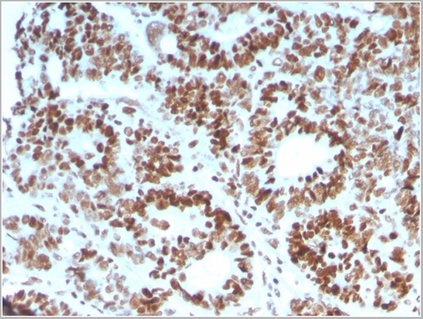 product-image-AAA23917_IHC2.jpg