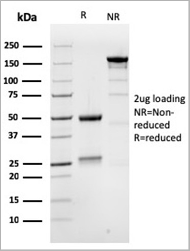 product-image-AAA23917_SDS_PAGE5.jpg
