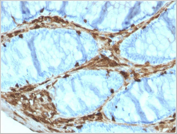 product-image-AAA23918_IHC.jpg