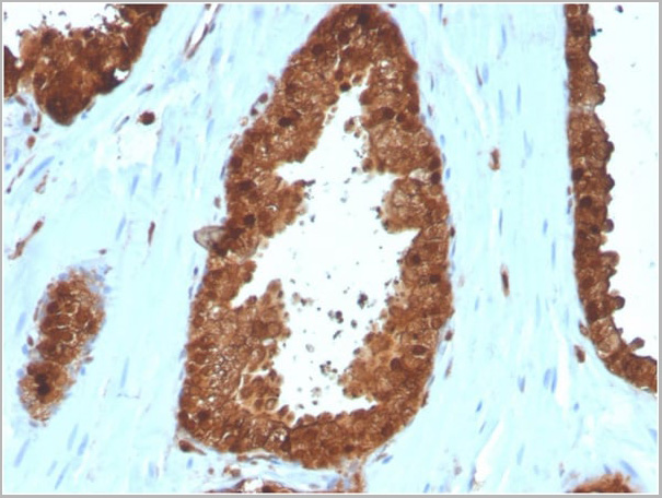 product-image-AAA23918_IHC2.jpg