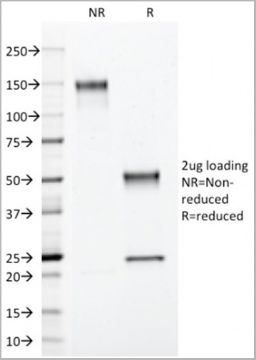 product-image-AAA23918_SDS_PAGE3.jpg