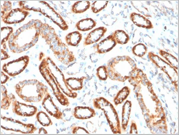 product-image-AAA23920_IHC.jpg