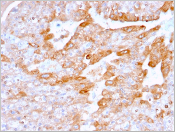 product-image-AAA23920_IHC2.jpg