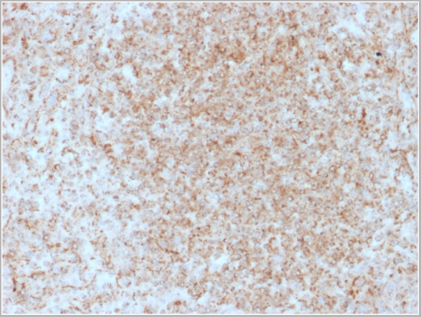 product-image-AAA23920_IHC3.jpg