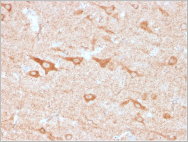 product-image-AAA23920_IHC4.jpg