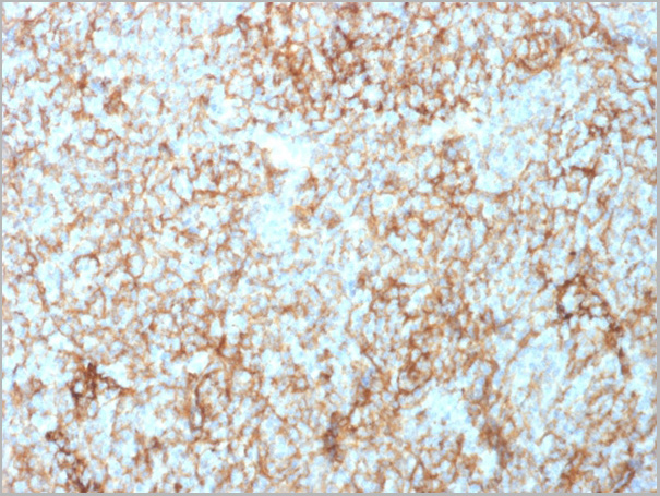product-image-AAA23926_IHC.jpg