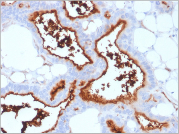 product-image-AAA23926_IHC2.jpg