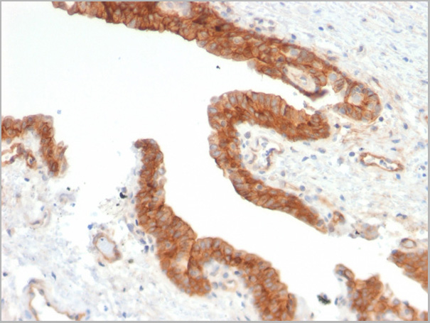 product-image-AAA23926_IHC3.jpg