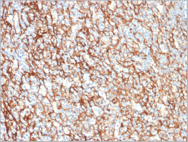 product-image-AAA23927_IHC2.jpg
