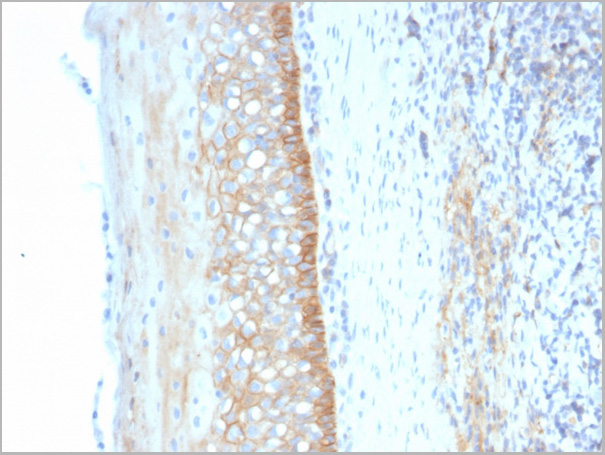 product-image-AAA23928_IHC2.jpg