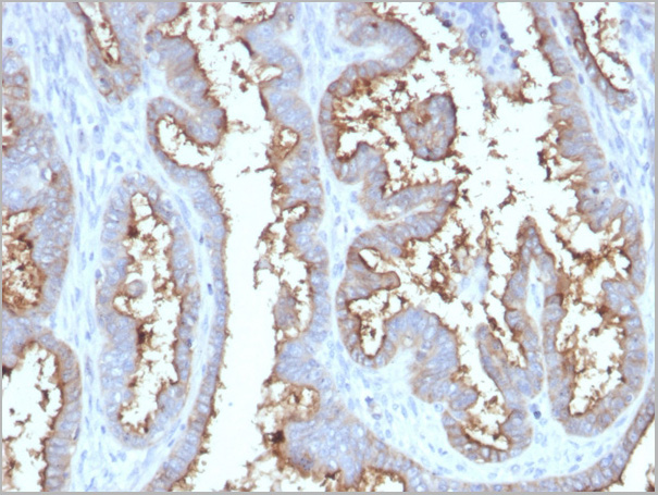 product-image-AAA23928_IHC3.jpg