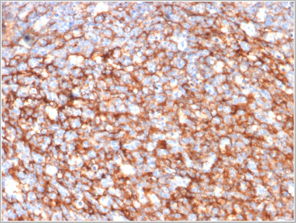 product-image-AAA23929_IHC.jpg
