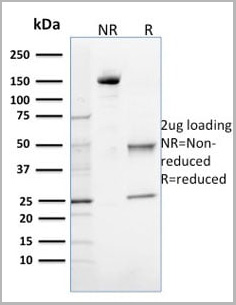 product-image-AAA23930_SDS_PAGE2.jpg