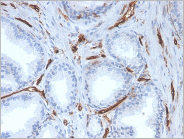 product-image-AAA23931_IHC.jpg