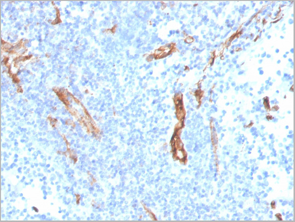 product-image-AAA23931_IHC2.jpg