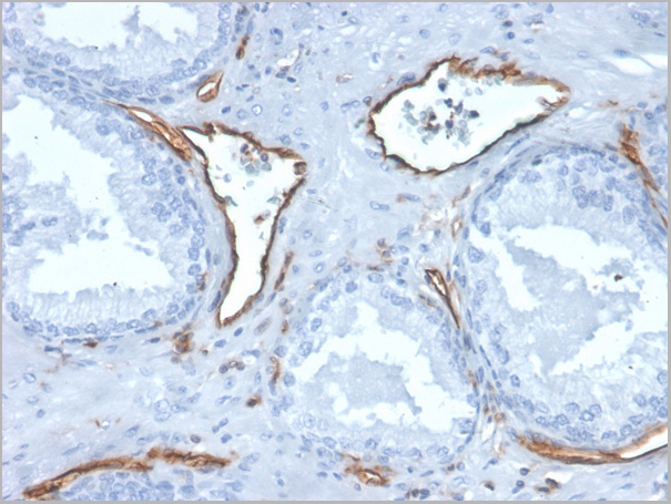 product-image-AAA23931_IHC3.jpg