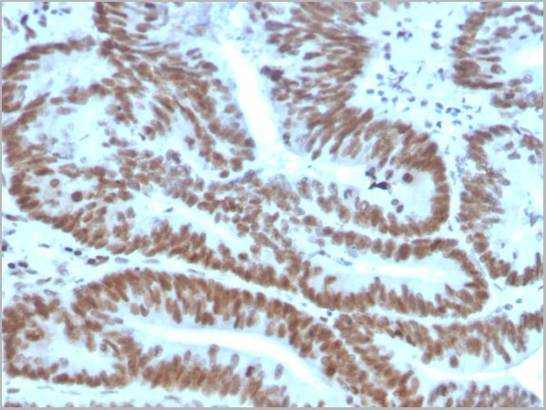 product-image-AAA23935_IHC2.jpg