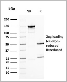 product-image-AAA23935_SDS_PAGE5.jpg