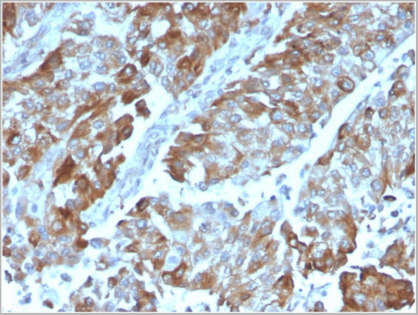 product-image-AAA23936_IHC.jpg