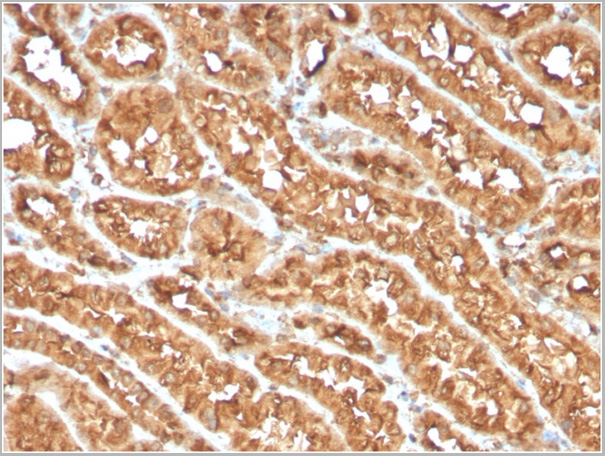 product-image-AAA23936_IHC2.jpg