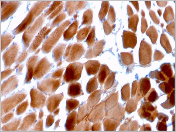 product-image-AAA23941_IHC.jpg