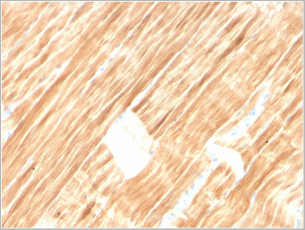 product-image-AAA23941_IHC2.jpg