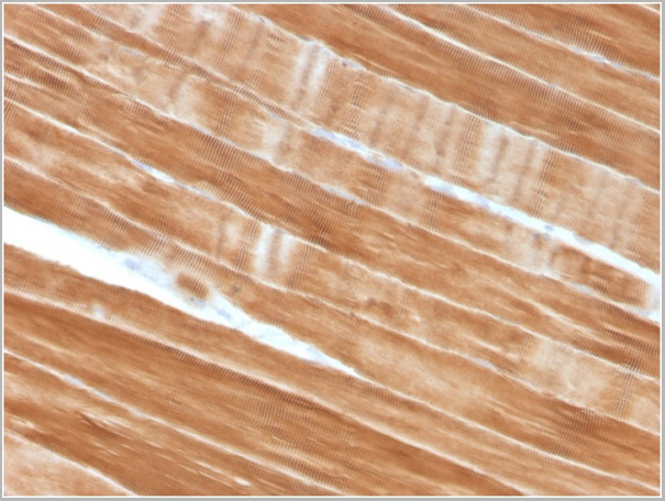 product-image-AAA23941_IHC3.jpg