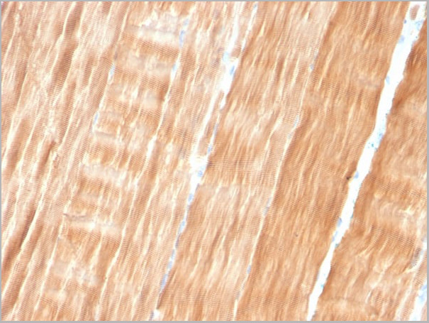 product-image-AAA23942_IHC.jpg