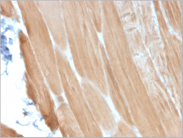 product-image-AAA23942_IHC2.jpg
