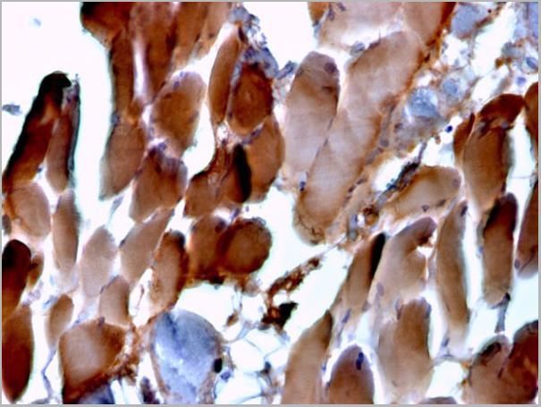 product-image-AAA23942_IHC3.jpg