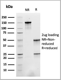 product-image-AAA23942_SDS_PAGE4.jpg