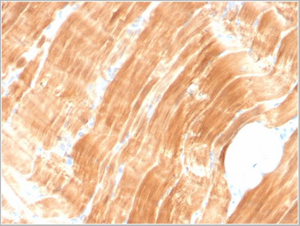 product-image-AAA23943_IHC.jpg