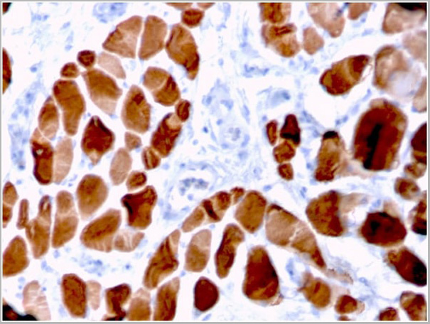 product-image-AAA23943_IHC2.jpg