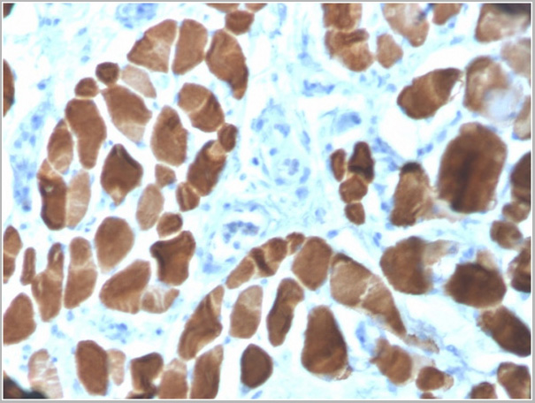 product-image-AAA23943_IHC3.jpg