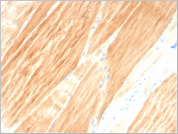 product-image-AAA23944_IHC.jpg