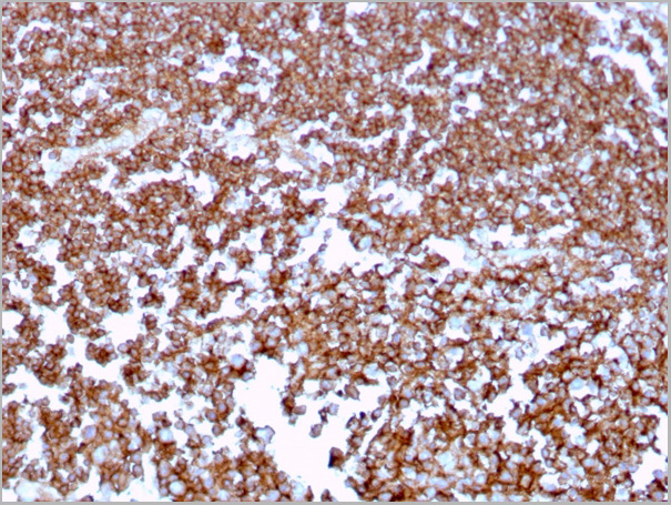 product-image-AAA23945_IHC.jpg