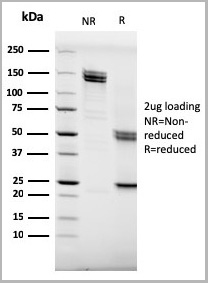 product-image-AAA23945_SDS_PAGE2.jpg