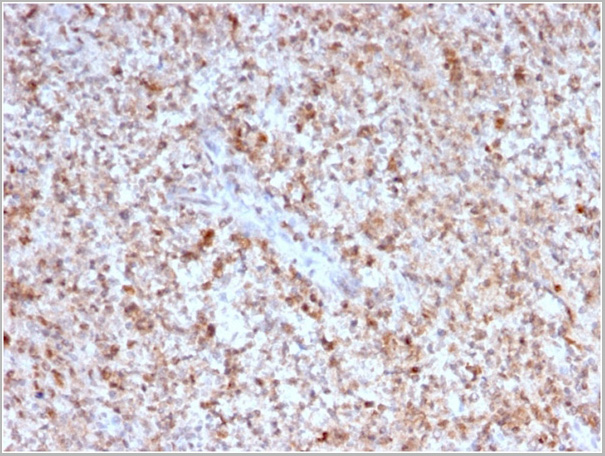 product-image-AAA23948_IHC.jpg